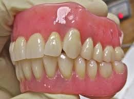 Welcome to best dental, the office of dr. What Is The Most Natural Looking Dentures