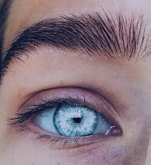 Black And Blue Eyes After Head Injury Wyndis Eye Wyndis Ojos Lindos Ojos Raros Fotos De Ojos