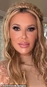 Brandi Glanville talks suffering 'deep depression' while battling facial  disfigurement: 'I look like a crackhead'