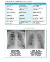 Pin By Vero Gil On Radiology Radiology Imaging Radiology Radiology Tech