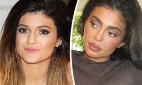 Reality TV stars including sisters Kylie and Kendall Jenner driving more  and more Australian teenagers towards cosmetic surgery