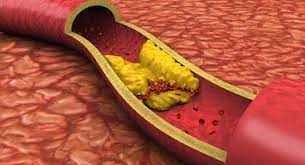 Where Can Blood Clots Form Symptoms Treatments And More