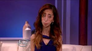 We did not find results for: Woman Called World S Ugliest Woman Becomes Inspiration To All Youtube