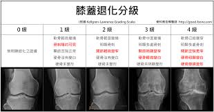 Kl 分類 膝