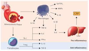 Jcm Free Full Text Inflammation As A Therapeutic Target In Atherosclerosis Html