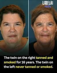 feeling unloved because of appearance