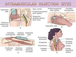 Intramuscular Injection Nursing Procedures Nurse Nursing Care