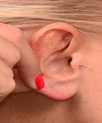More often than not, this method may help temporarily, but will generally irritate the skin to the point that it will no longer work. Earlobe Repair Sandy Springs Earlobe Surgery Dunwoody