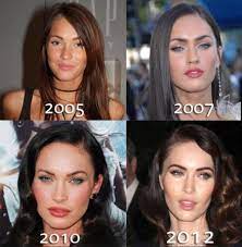Megan fox burst onto the hollywood scene after starring alongside shia labeouf in 2007. Megan Fox Face Plastic Surgery Chin Lips And Nose Before And After Liparteasy Lipfillersshapes Gesicht Plastische Chirurgie Schonheit