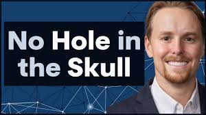 Brain implants without a hole in your skull