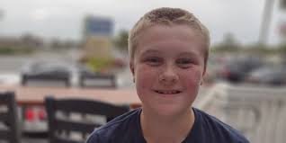 11-year-old from Bernie has hope he'll overcome severe allergies