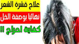 طريقة إزالة قشرة الشعر بالخل Youtube