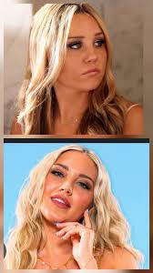 Did celebrities have plastic surgery?