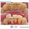 How to reverse gum disease in dogs. 1