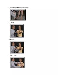 Image result for Rapid Alternating Movements