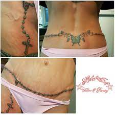 Maybe you would like to learn more about one of these? Tattoo Cover Up For Tummy Tuck Scars Novocom Top