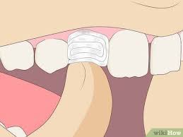 If it's a primary tooth, the permanent tooth coming in behind it will push it out on its own. The 3 Best Ways To Pull Out A Tooth Without Pain Wikihow
