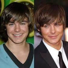 The actor teamed up with other celebrities including justin bieber, good girls' retta, tiktok stars dixie and charli d'amelio, steve aoki, and others in a call for climate change action. Zac Efron Plastic Surgery Nose Job Celeb Surgery Com