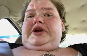 1000 Lb Sisters Amy Slaton Reveals Risky Pregnancy Soap Dirt