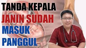Bagaimana sih cara mengenali air ketuban yang merembes? Gejala Ketuban Pecah Tanyakan Dokter Youtube