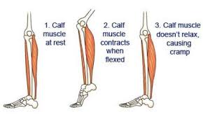 Pin On Home Remedies Cramps Spasms