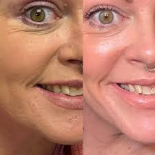 you're still pretty with those scars‚ stretch marks‚ acne & weight gain etc.