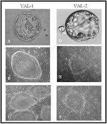 Check spelling or type a new query. First Derivation In Spain Of Human Embryonic Stem Cell Lines Use Of Long Term Cryopreserved Embryos And Animal Free Conditions Fertility And Sterility