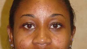 Coastal Carolina Downs Winthrop 8-4 In Second Round Of Big South Tournament  (5-27-04)