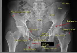 They form a large sheet of skeletal muscle that is thicker in some areas than in others. Ct Anatomy Abd Pelvis Extremities Flashcards Quizlet