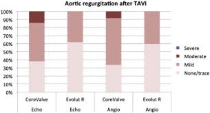 Transcatheter Aortic Valve Implantation With The New