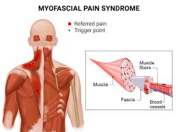 Image result for Pain Disorder