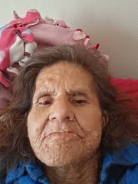 Anyone hands turn blue