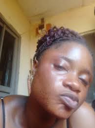 please what can my sister use to clear this