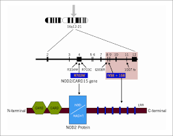 New Findings Shed Light On Nod2 Associated Autoinflammatory Disease Consult Qd