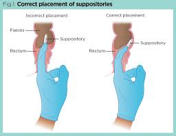Digital rectal examination for osces. Overcoming Barriers To Nurses Performing Digital Rectal Examination Nursing Times