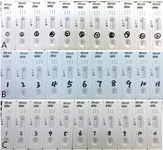 Compared to the two other commonly used techniques. False Negative Rt Pcr And False Positive Antibody Tests Concern And Solutions In The Diagnosis Of Covid 19 Journal Of Infection
