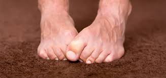 Ski mask the slump god foot fungus choreography by jason rodelo x julian de guzman.mp3. 4 Funny Fairytales Debunked About Foot Fungus Treatment Eup