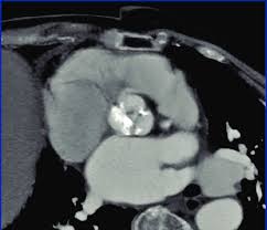 We would like to show you a description here but the site won't allow us. Transversal Plane Of Muliplanar Reconstrucion Of A Cardiac Msct This Download Scientific Diagram