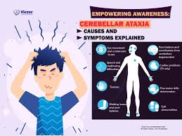 Image result for Ataxia