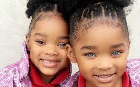 Nhờ sở hữu đôi mắt đặc biệt chưa từng thấy, cặp sinh đôi bỗng chốc nổi  tiếng khắp thế giới