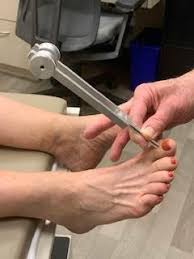 Image result for Tuning Fork Test