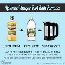 Why Choose Listerine As A Foot Soak How It Works Recipes Listerine Feet Listerine Foot Soak Listerine