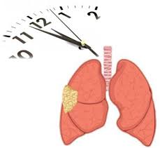 Check spelling or type a new query. How Long Does It Take For Mesothelioma To Develop Public Health