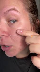 This Korean skincare duo is designed to fight fine lines, improve elas...