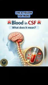 Image result for CSF Blood