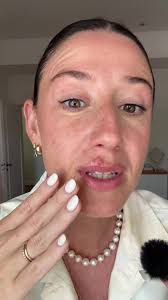 Les mando un besito virtual con #herpes 😘