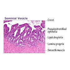 Image result for Seminal Vesicle