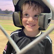 Why is my Garmin Livescope glitching and failing to calibrate?