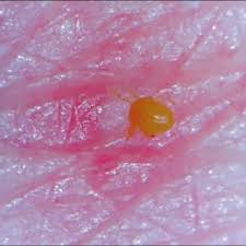 Image result for Trombicula autumnalis bites