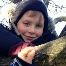 Quadruple meningitis amputee baby's family